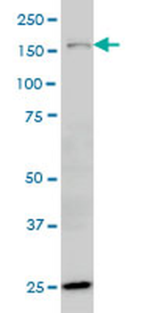 HYOU1 monoclonal antibody (M01), clone 6F7