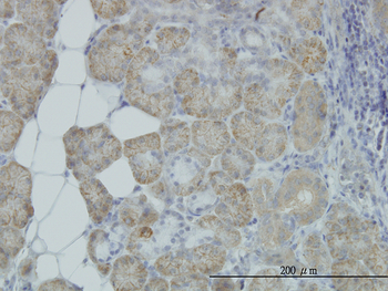 HYOU1 monoclonal antibody (M01), clone 6F7
