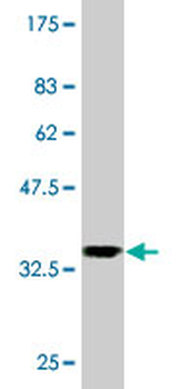 CHERP monoclonal antibody (M01), clone 2H5
