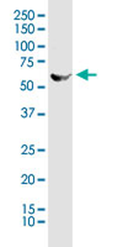 STK25 monoclonal antibody (M01), clone 1G6