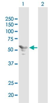 STK25 monoclonal antibody (M01), clone 1G6