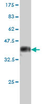 STK25 monoclonal antibody (M01), clone 1G6