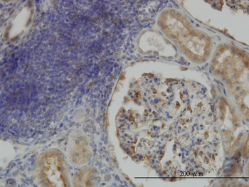 CRTAP monoclonal antibody (M01), clone 4D9