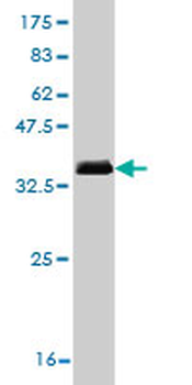 CRTAP monoclonal antibody (M01), clone 4D9