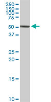 CAP1 MaxPab rabbit polyclonal antibody (D01)