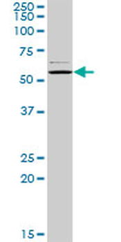 CAP1 MaxPab rabbit polyclonal antibody (D01)