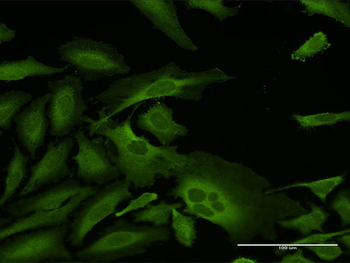 CAP1 MaxPab rabbit polyclonal antibody (D01)