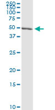 CAP1 MaxPab rabbit polyclonal antibody (D01)