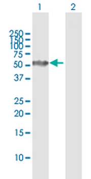 CAP1 MaxPab rabbit polyclonal antibody (D01)