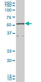 CAP1 purified MaxPab mouse polyclonal antibody (B01P)