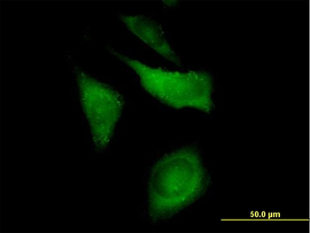 CAP1 purified MaxPab mouse polyclonal antibody (B01P)