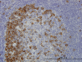 TACC3 monoclonal antibody (M02), clone 6C4