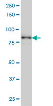 TACC3 monoclonal antibody (M02), clone 6C4