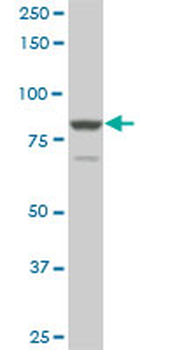 TACC3 monoclonal antibody (M02), clone 6C4