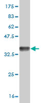 TACC3 monoclonal antibody (M02), clone 6C4
