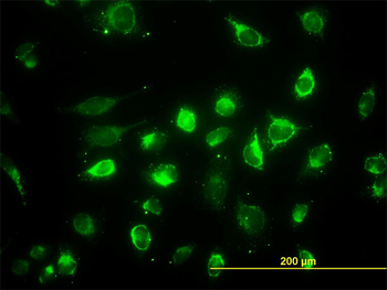 ACAA2 monoclonal antibody (M01), clone 5C4