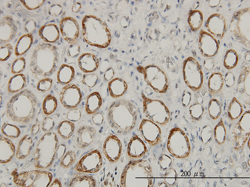 ACAA2 monoclonal antibody (M01), clone 5C4