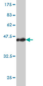 ACAA2 monoclonal antibody (M01), clone 5C4
