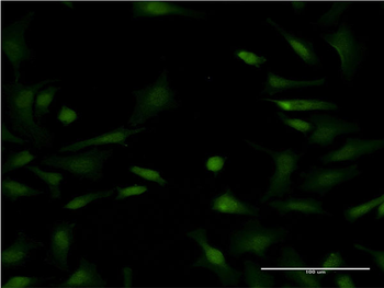 LYPLA1 monoclonal antibody (M05), clone 3D5