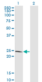 LYPLA1 monoclonal antibody (M05), clone 3D5