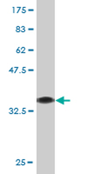 LYPLA1 monoclonal antibody (M05), clone 3D5