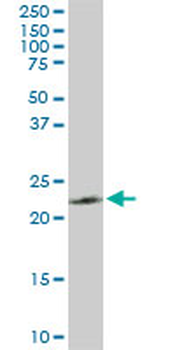 PGRMC2 monoclonal antibody (M04), clone 3C11