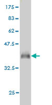 PGRMC2 monoclonal antibody (M04), clone 3C11