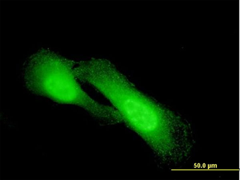 NDRG1 monoclonal antibody (M03), clone 2D7