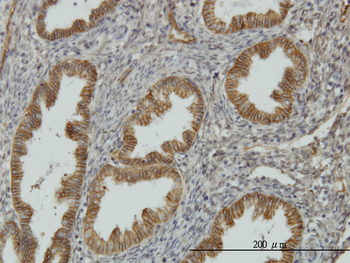 NDRG1 monoclonal antibody (M03), clone 2D7