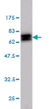 NDRG1 monoclonal antibody (M03), clone 2D7