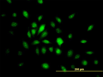 HMG20B monoclonal antibody (M01), clone 1F6