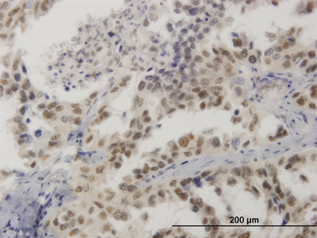 HMG20B monoclonal antibody (M01), clone 1F6
