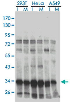 HMG20B monoclonal antibody (M01), clone 1F6