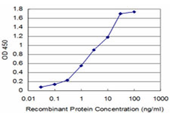 AKR1A1 monoclonal antibody (M01), clone 1A11-2A4