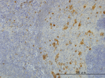 AKR1A1 monoclonal antibody (M01), clone 1A11-2A4