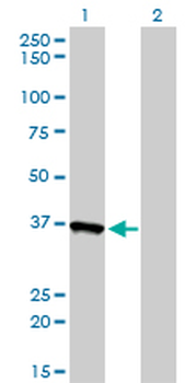 AKR1A1 monoclonal antibody (M01), clone 1A11-2A4