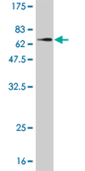 AKR1A1 monoclonal antibody (M01), clone 1A11-2A4