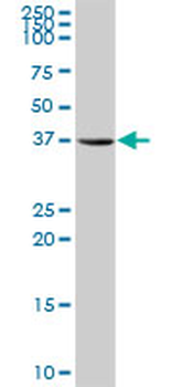 AKR1A1 purified MaxPab rabbit polyclonal antibody (D01P)
