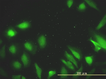 DNAJA2 monoclonal antibody (M01), clone 2A11-F2