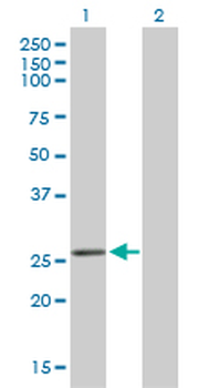 BCAS2 monoclonal antibody (M01), clone 1D10