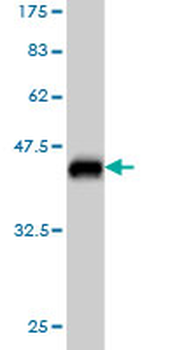 BCAS2 monoclonal antibody (M01), clone 1D10
