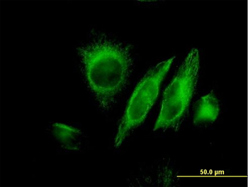 SPRY2 monoclonal antibody (M01), clone 1E10