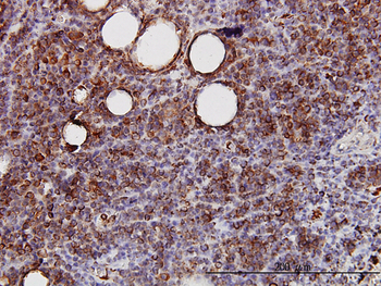 SPRY2 monoclonal antibody (M01), clone 1E10