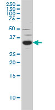 SPRY2 monoclonal antibody (M01), clone 1E10