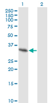 SPRY2 monoclonal antibody (M01), clone 1E10