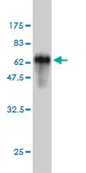 SPRY2 monoclonal antibody (M01), clone 1E10