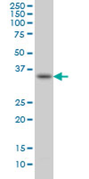 SPRY1 monoclonal antibody (M01), clone 3H4
