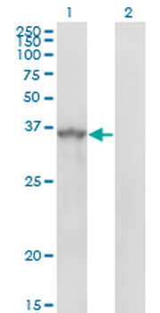 SPRY1 monoclonal antibody (M01), clone 3H4