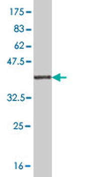 RASGRP2 monoclonal antibody (M09), clone 3D8