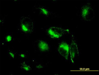 STX6 monoclonal antibody (M01), clone 1G2